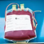 Anesthesiologists Play a Pivotal Role in  Mitigating the Type O-Negative Blood Shortage